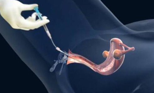 武汉试管婴儿医院有哪些？