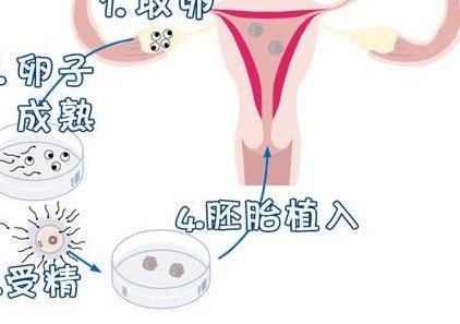 杭州助孕服务哪家强？三巨头生育服务大揭秘，助您轻松踏上备孕之旅