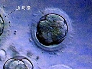 马来西亚试管婴儿第几代技术比较好？